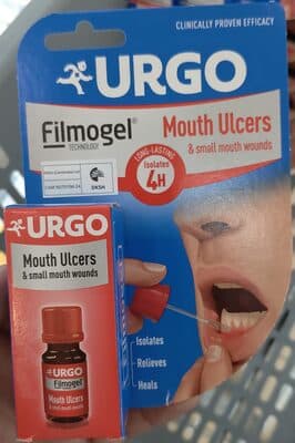 Mouth ulcer